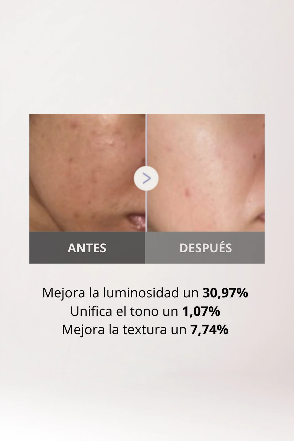 AGE-R Booster Pro Mini White