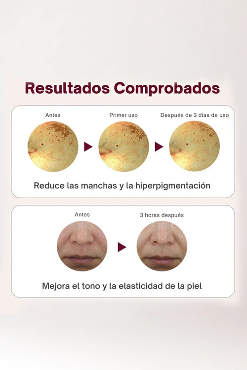 CENTELLIAN24 - Set de ampollas Expert Madeca Mela Capture
